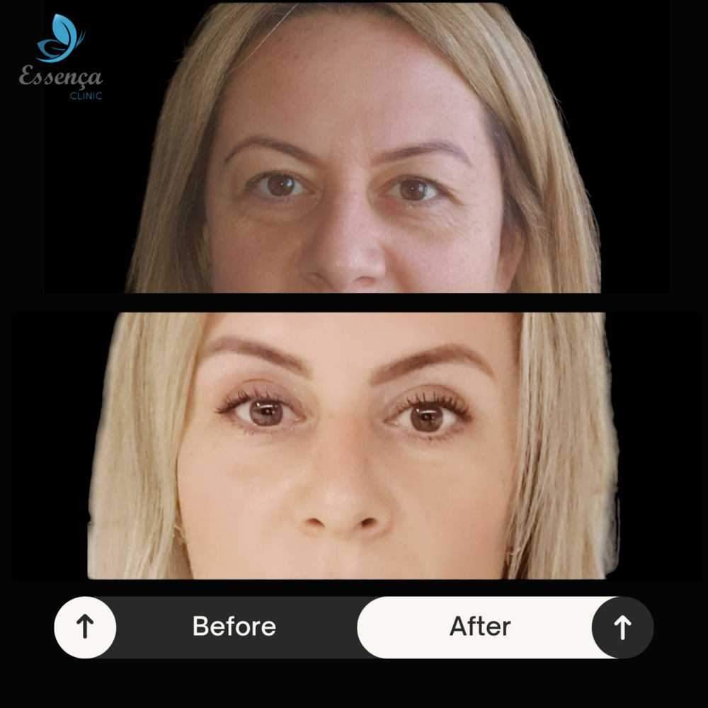 Clinic Results Gallery